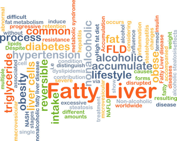 A word cloud on fatty liver disease; risk factors, such as alcohol and high fat diet, appear in different colors